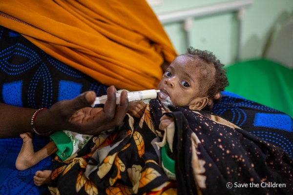 소말리아의 세이브더칠드런 안정화센터에서 영양 강화 우유를 먹는 영양실조 아동 카밀라(5개월, 가명) ⓒMustafa Saeed_Save the Children