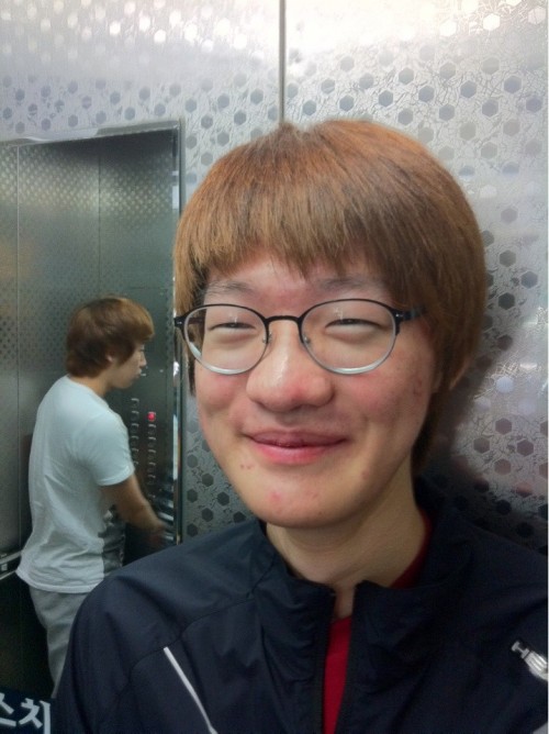 양악 수술 마친 KT 김대엽 "다른 사람이네"