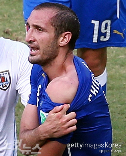 이탈리아의조르지오키엘리니가우루과이의루이스수아레스에게물린이빨자국을심판에게보여주며항의하고있다(사진=ⓒGettyImages/멀티비츠제공)