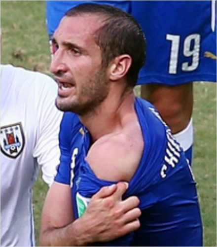 '그럼이건모기가문건가?'이탈리아조르지오키엘리니가우루과이와경기도중루이스수아레스에물린상처를보이고있는모습.(사진=게티이미지)