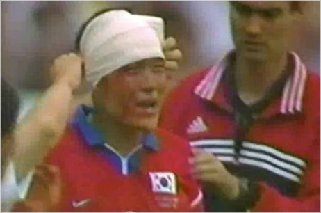 1998년프랑스월드컵벨기에와의최종전당시이임생선수가부상을당해붕대를감고있다.(유튜브영상캡쳐)