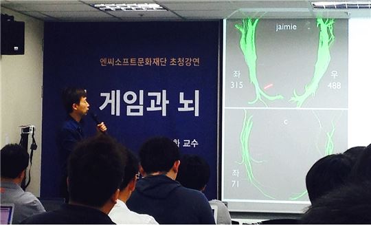 게임 이용자의 뇌 다발(위), 비 이용자의 뇌 다발 아래