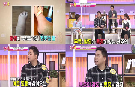 <엄지의 제왕> 현주엽 "은퇴 이후에도 무릎, 발목 통풍 시달려!