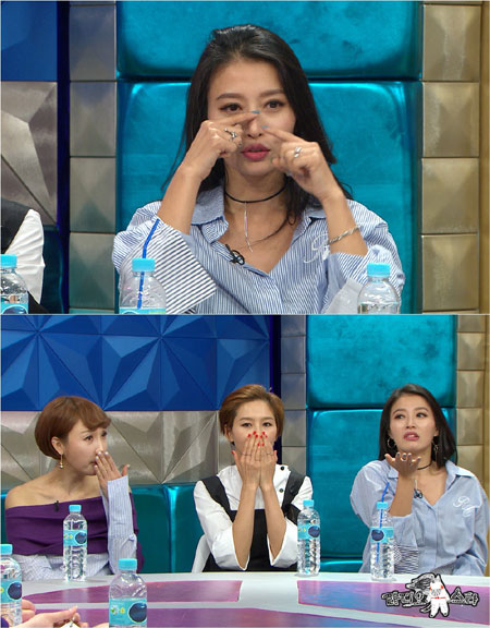 '라디오스타' 황보, 4년 전 ‘부러진 코뼈’ 치료 없이 방치 중 고백!
