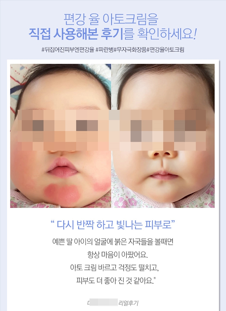 편강율 아토크림 광고 이미지.(사진=GS샵 캡처)