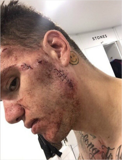 "고의성 없다" 리버풀, 마네 3경기 출전 정지 징계 항소