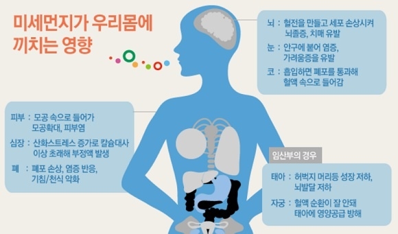 미세먼지가 우리 몸에 미치는 영향, 사진=SK하이닉스 블로그