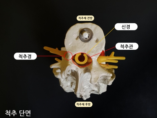 국제성모병원, 김영욱 교수 척추관협착증 새 원인 규명 ‘쾌거’