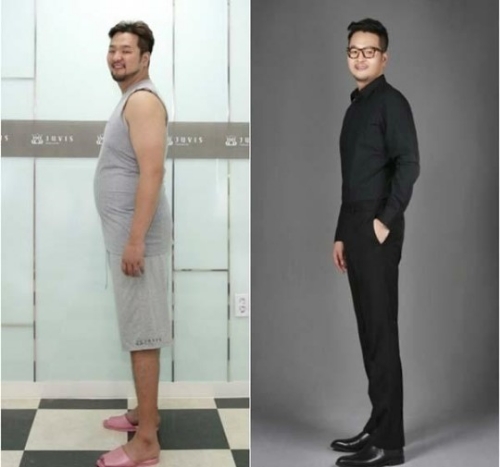 ⓒ 비만관리업체 A사