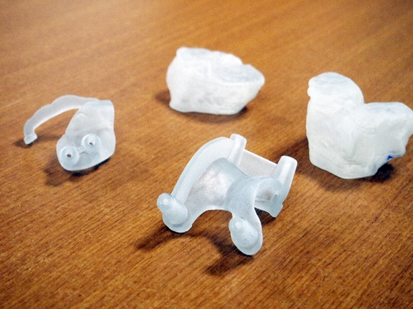 3D프린터로 출력된 환자의 무릎모형과 맞춤형 인공관절 수술도구