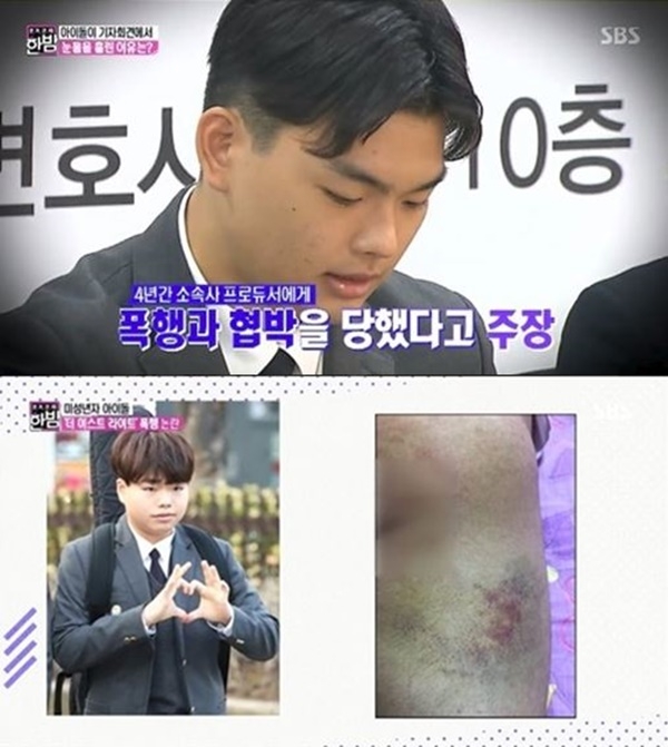 더 이스트라이트 이석철-이승현, 안타까운 폭행 흔적…대표 겁박까지 ‘충격’
