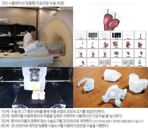 강남 연세사랑병원 인공관절 연구센터, 환자 맞춤형 수술로 정확도 높혀..