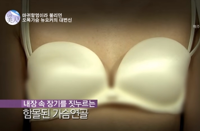 렛미인 방영 오목가슴