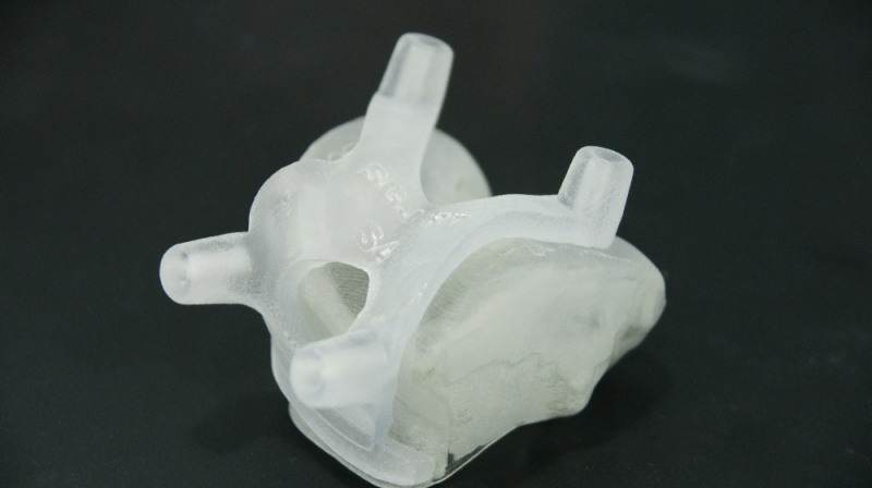 사진=3D 프린터로 출력한 무릎 윗뼈 모형과 수술도구