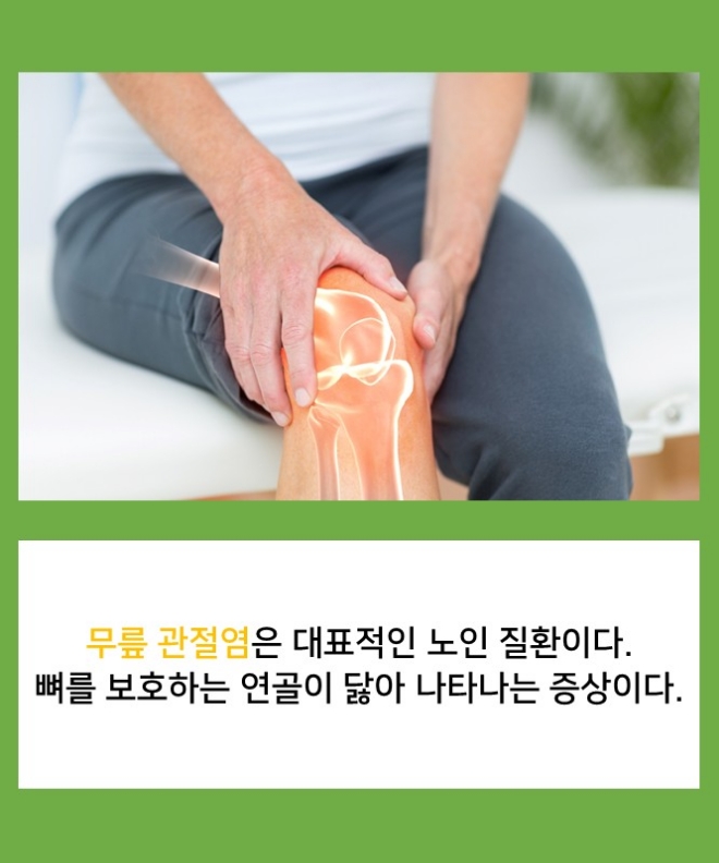 [카드뉴스] '무릎 관절염' 수술비 부담 줄어든다!