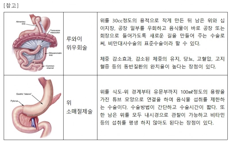 여의도성모병원, 비만대사수술 클리닉 본격 운영