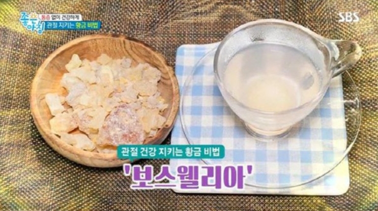 사진=SBS 좋은 아침