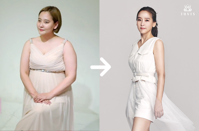 가수다나제공ㅣ쥬비스다이어트