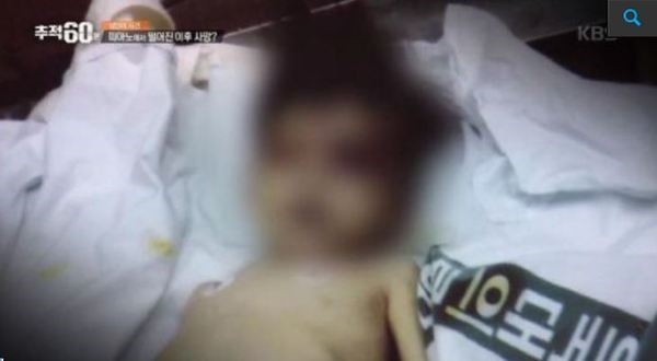 '울산 성민이 사건'의 눈으로 보기 힘든 장면 / 출처 : 방송캡쳐