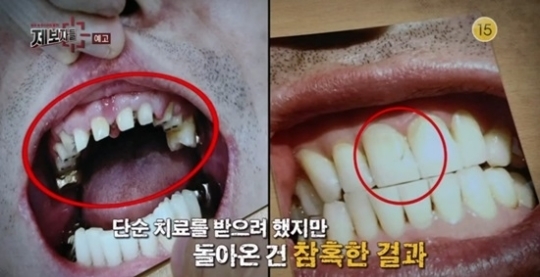 시청자 상당수 "막가파 수준 치과"...제보자들 치과 왜? '두려움의 장소' 환자는 그저 로또였나