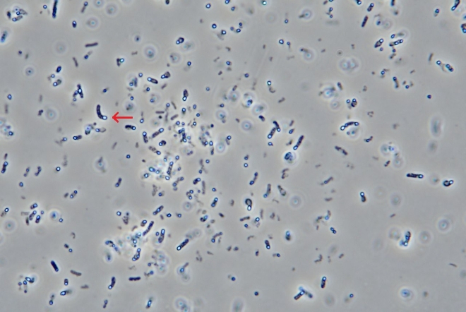 대웅제약 '나보타 균주, 포자감정시험 통해 메디톡스와 다른 균주 입증'