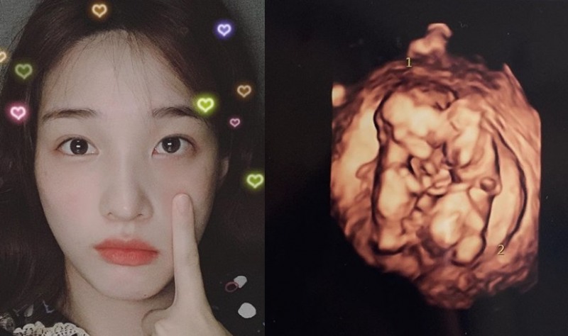 사진=율희인스타그램