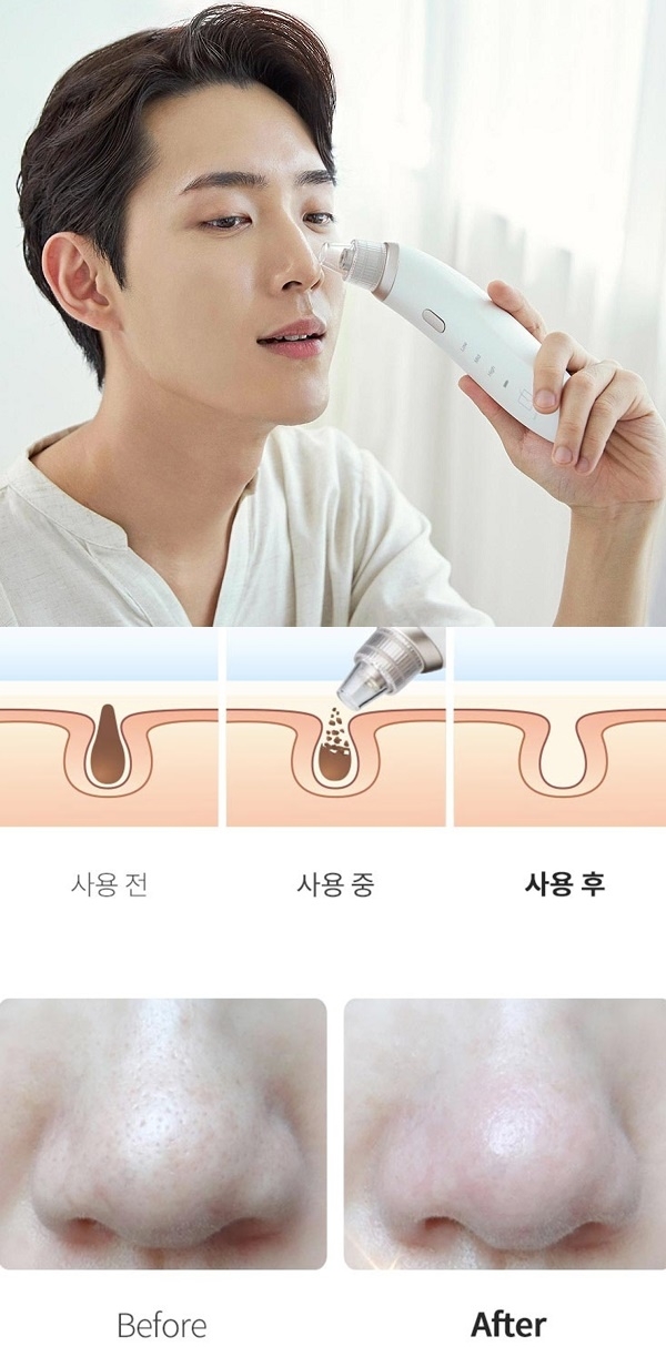 포토 : 페이스팩토리