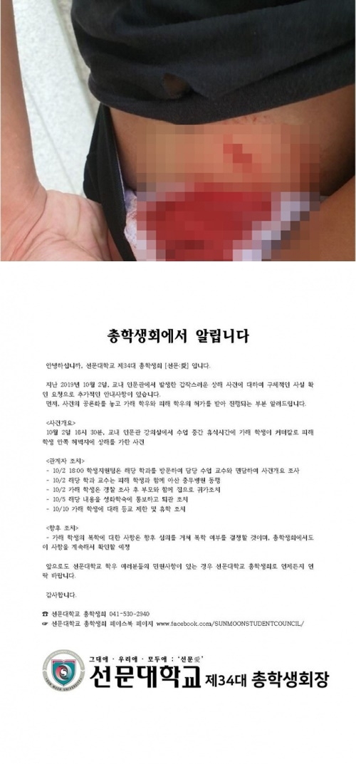 포토 : 인터넷 게시판