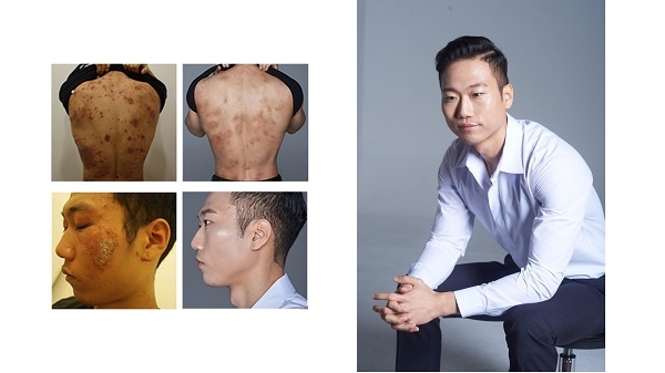 스킨케어 브랜드 포엑스, 피부 스트레스 편안하게 낮춰주는 릴렉싱 클렌징바 인기