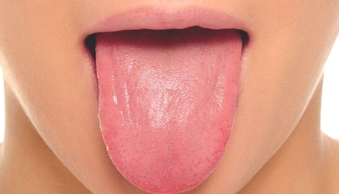 혀