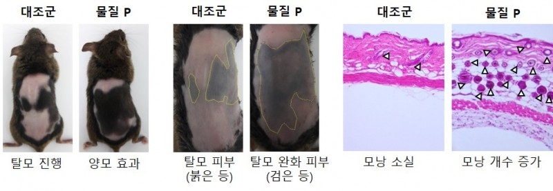 바이오솔루션, ‘탈모 관련 기술’ 해외 특허지원사업에 선정