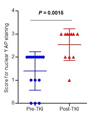 항암치료 전(Per-TKI) YAP 유전자가 세포질내(1~2)에 많은 것으로 확인됐지만 항암치료 후(Post-TKI) 세포핵 내(3)에 YAP 유전자가 더 많이 측정됐다.