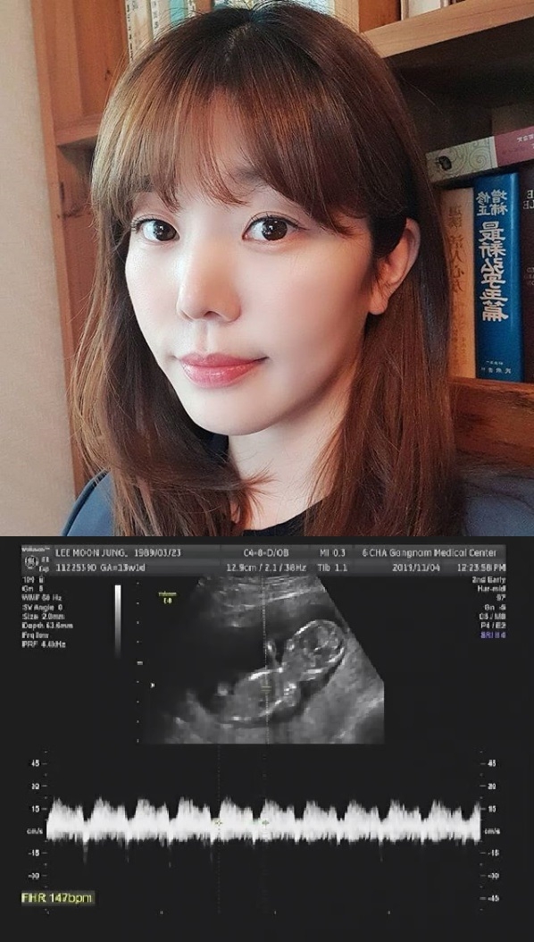 사진=이문정 SNS