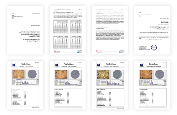 닥터포헤어 폴리젠 샴푸와 토닉, 독일 ‘트리코스캔’ 임상결과 공개