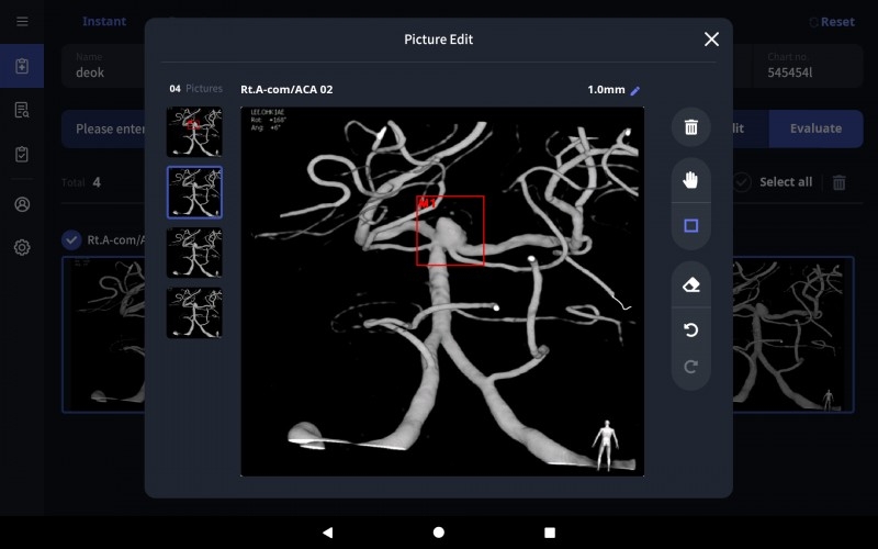 NAO DETECTION AI 소프트웨어 화면