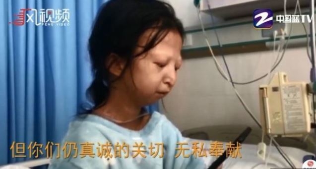 극빈생활로 인해 24세 나이에도 불구하고 20kg의 몸무게를 가진 중국 여성 우화옌의 사연이 지난해 10월 중국 TV방송을 통해 보도되고 있는 장면. 영국 BBC는 병원 입원 치료에도 불구하고 우화옌이 결국 13일에 사망했다고 보도했다 .