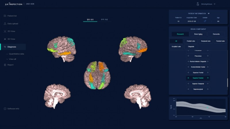 인공지능 뇌 노화 분석 솔루션 정식 상용화 서비스 시작