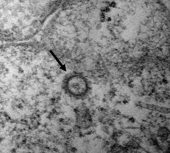 신종 코로나바이러스(SARS-CoV-2) 입자를 전자 현미경으로 확대한 모습. 입자 크기는 80~100㎚(나노미터). ㎚는 1000만㎝분의 1에 해당하는 크기다./질병관리본부 제공