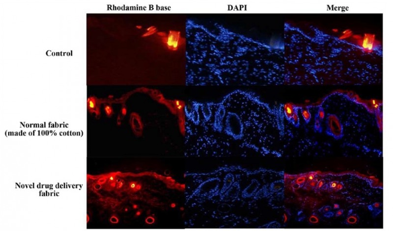 그림1_형광물질반응 현미경 검사 이미지(일반직물v약물전달특수직물 비교)/실험쥐 피부에 형광물질 염료가 적용된 크림을 도포 후 피부 노출상태(Control), 일반직물(Normal fabric), 약물전달 특수직물(Novel drug delivery fabric)을 각각 사용해 6시간 뒤 형광 현미경 검사 결과, 약물전달 특수직물을 사용한 경우 로다민B(Rhodamine B base) 색소가 가장 많이 검출되었다.