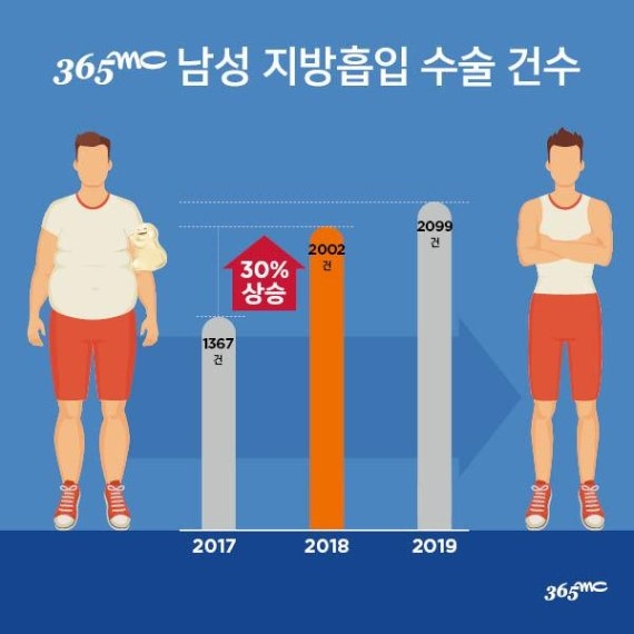 남성이 원하는 '지방흡입' 부위는 복부? 팔뚝? 정답은…