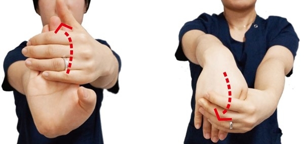 저릿저릿한 손, 원인은 팔꿈치? 손목?