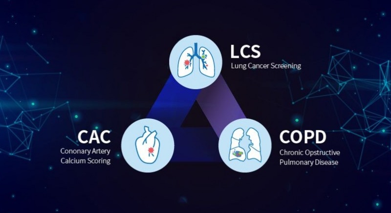 폐암 진단, 인공지능을 장착하다