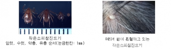 SFTS를매개하는작은소피참진드기(질병관리본부)