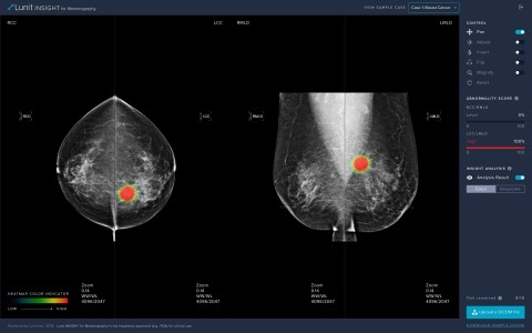 유방암 검출 AI 소프트웨어 ‘루닛 인사이트 MMG’, 유럽 CE 인증 획득