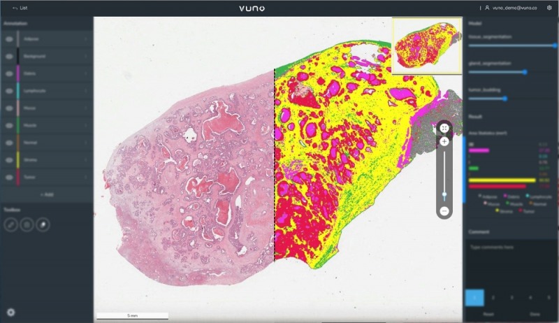 참고자료: 뷰노메드 패스랩™(VUNO Med®-PathLab™) 스크린샷