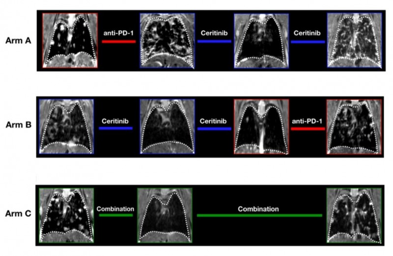 형질전환 마우스에서 면역항암제 후 ALK억제제(ArmA), ALK 억제제 이후 면역항암제(ArmB), ALK 억제제와 면역항암제 병합요법 (Arm C)의 폐 변화 영상. Arm A의 경우 면역항암제(anti-PD-1) 투여 후 폐암이 악화됐다. ALK 억제제(ceritinib) 투여 후에도 상황이 나아지지 않았다. Arm B의 경우 ALK 억제제 투여 후 증상이 호전됐지만 면역항암제 투여 후 상태가 나빠졌다. Arm C에서 면역항암제와 ALK 억제제를 병용한 결과 상황이 더 나빠진 것을 확인할 수 있다.