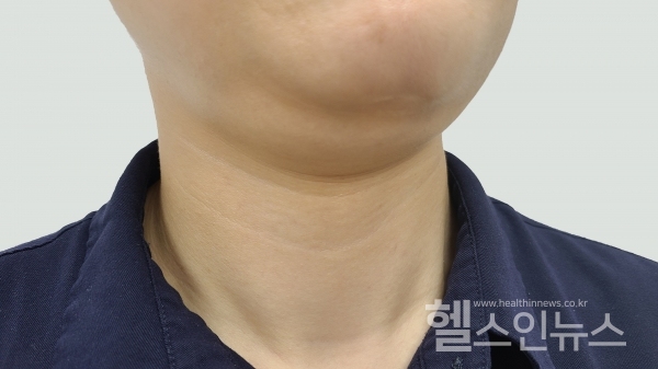 고려대구로병원제공