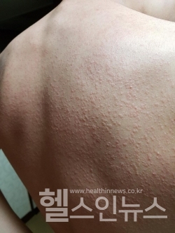 한림대학교동탄성심병원제공