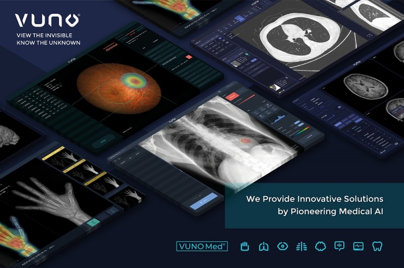 뷰노, 군 의료 AI 솔루션 구축 실증 컨소시엄으로 선정