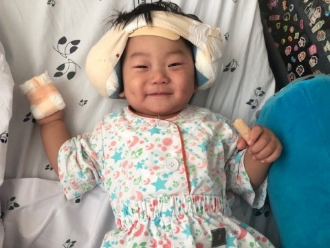사진: 인공달팽이관 수술을 받고 회복 중인 윤호(2살, 가명)